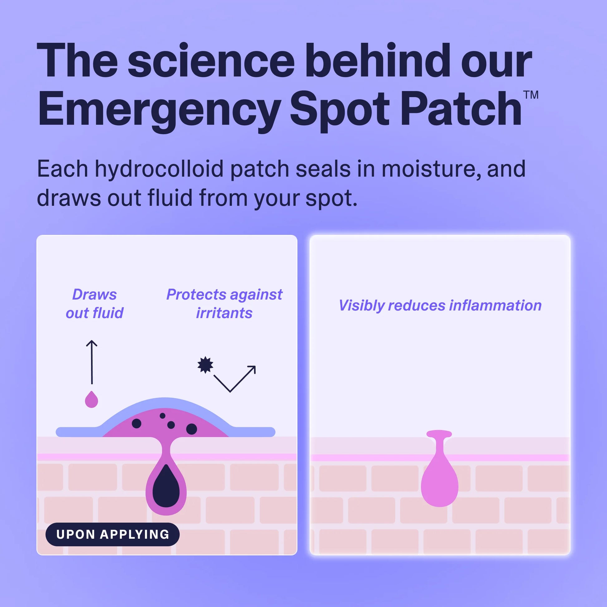 Emergency Spot Patch, Hydrocolloid Pimple Patches for Acne, 40 Count